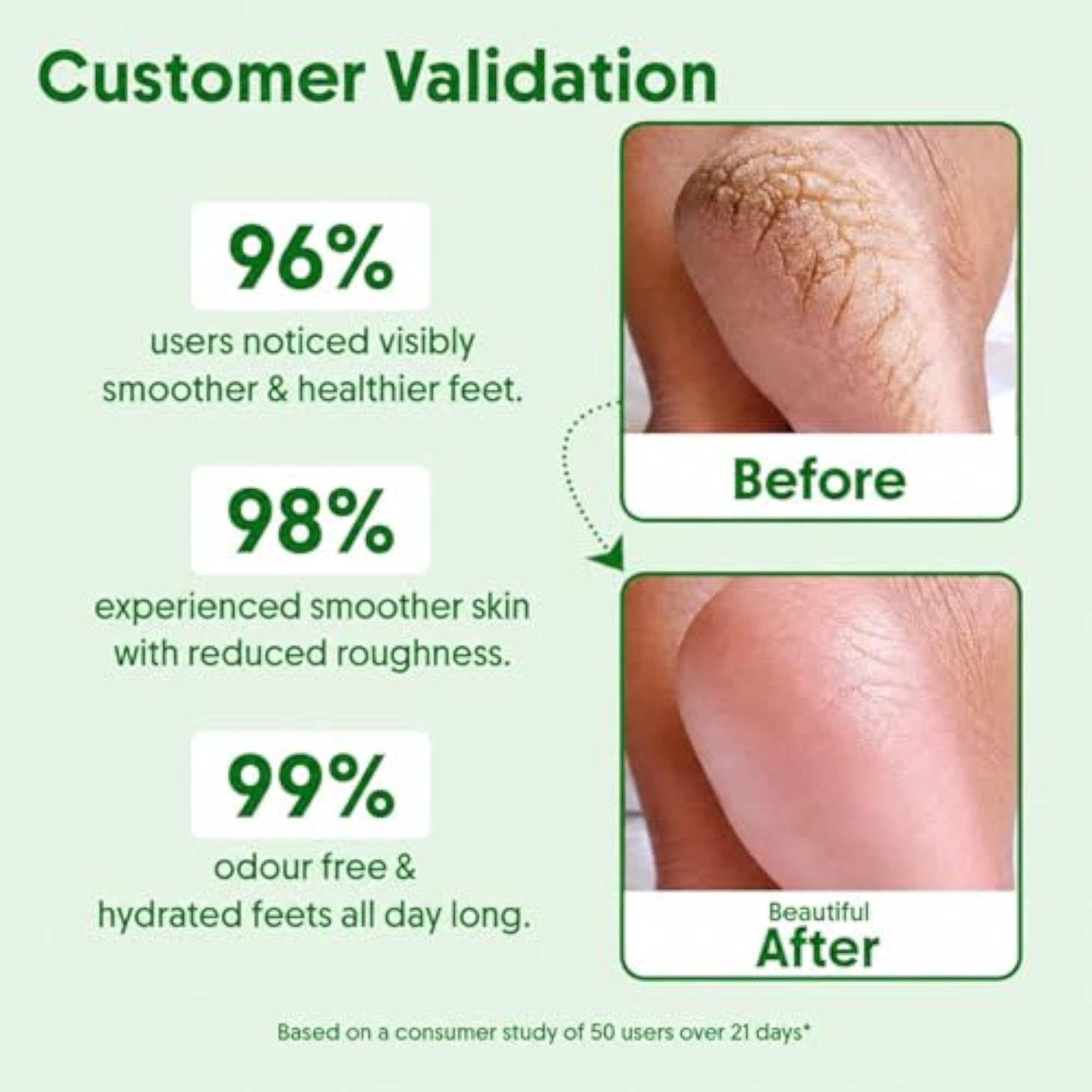 20% Urea Foot Cream Roll-On for Dry Skin